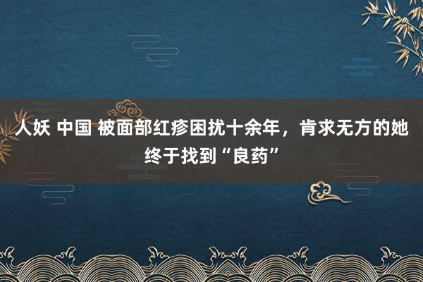 人妖 中国 被面部红疹困扰十余年，肯求无方的她终于找到“良药”